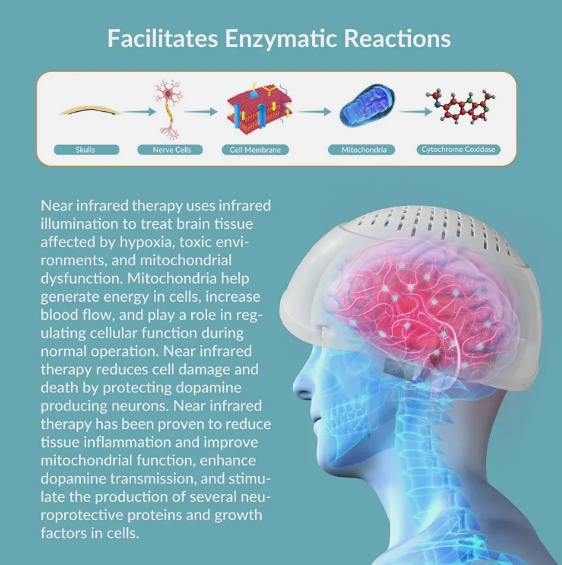 2026 Innovative 810nm Light Theray Photobiomodulation Helmet for Relieving Migraine and Anxiety Symptoms Stroke Recoveryts