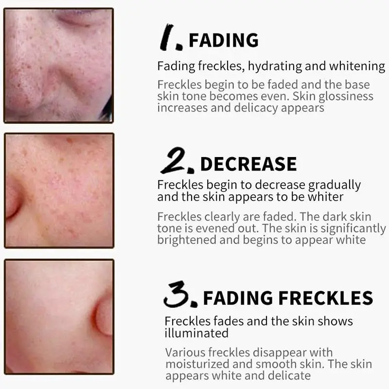 Face Cream Collagen Freckles Whitening Day Cream Hyaluronic Acid Anti-Aging Anti-Wrinkle Remove Spot