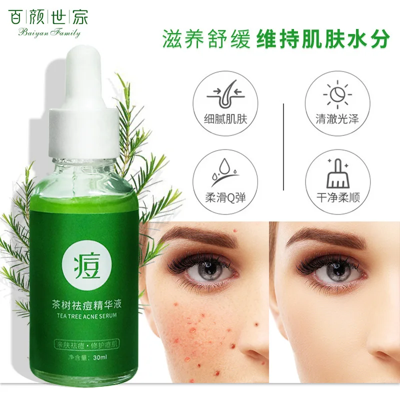 30ml Acne removing essence of alternate leaf white tea tree can eliminate acne, fade acne marks and refine pores essence 1pcs