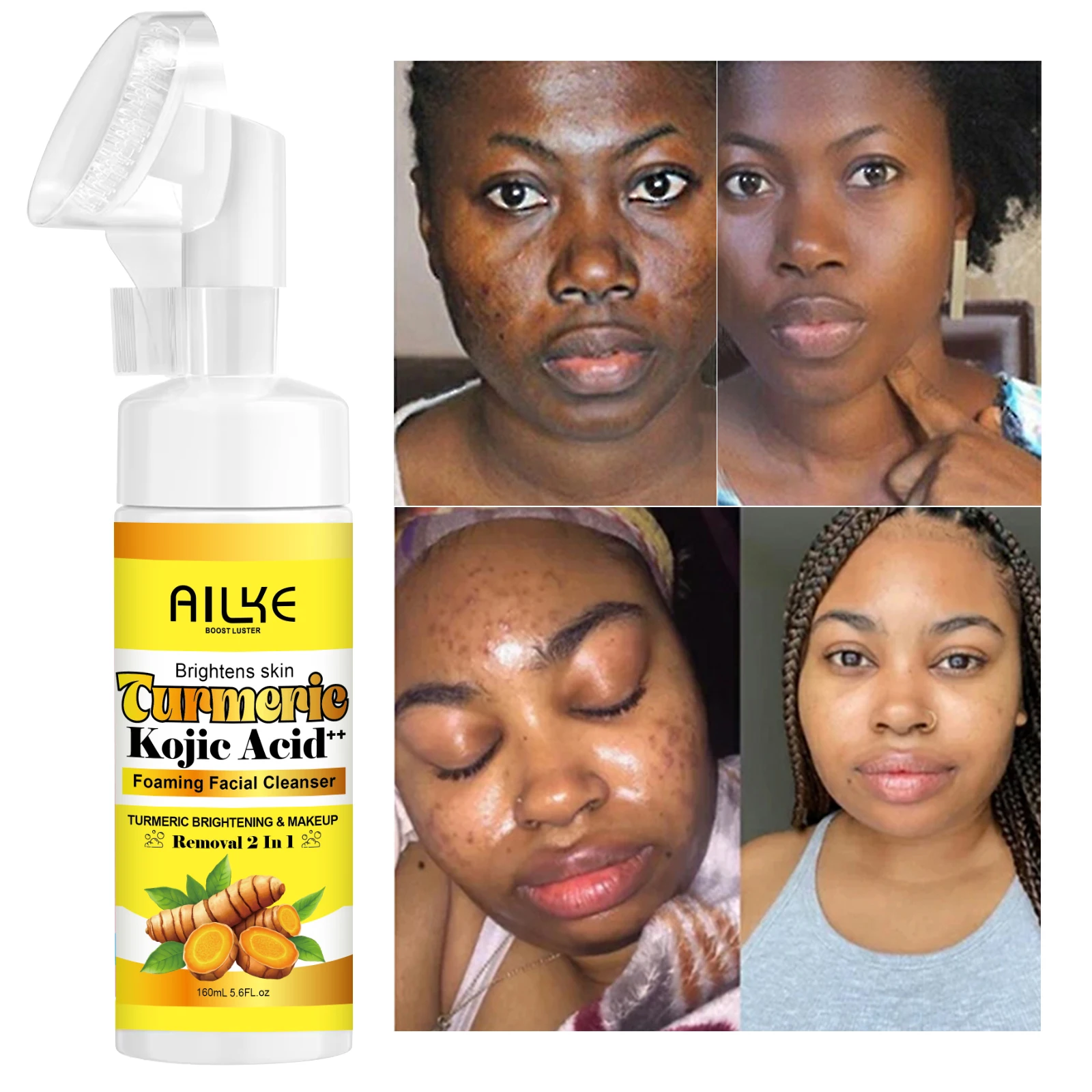 AILKE Limpiador facial espumoso iluminador, con cúrcuma natural, ácido kójico, elimina residuos de maquillaje y acné, piel limpia, 160 ml