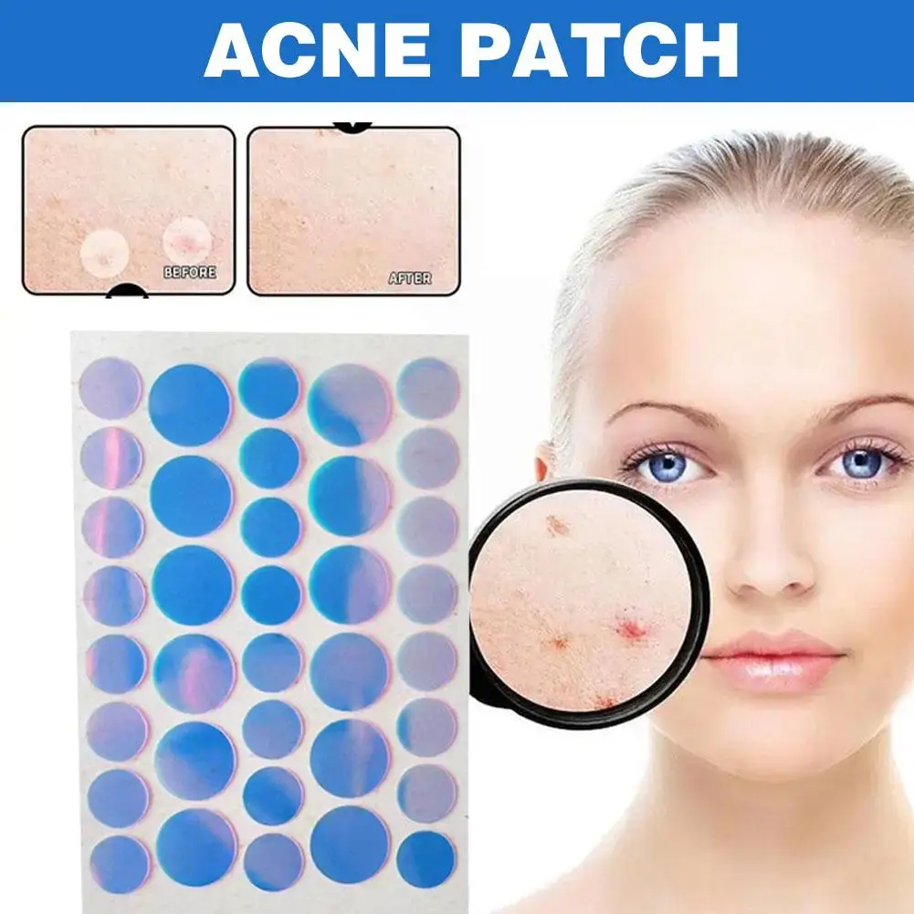 Laser Round Shape Pimple Patches Colorful Hydrocolloid Pimple Face Care Cute Strong Sticker Healing Patches Absorption Zit N5m2