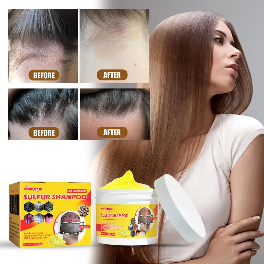 Deep Cleaning Effective Hair Treatment Dandruff Sulfur Shampoo for Home