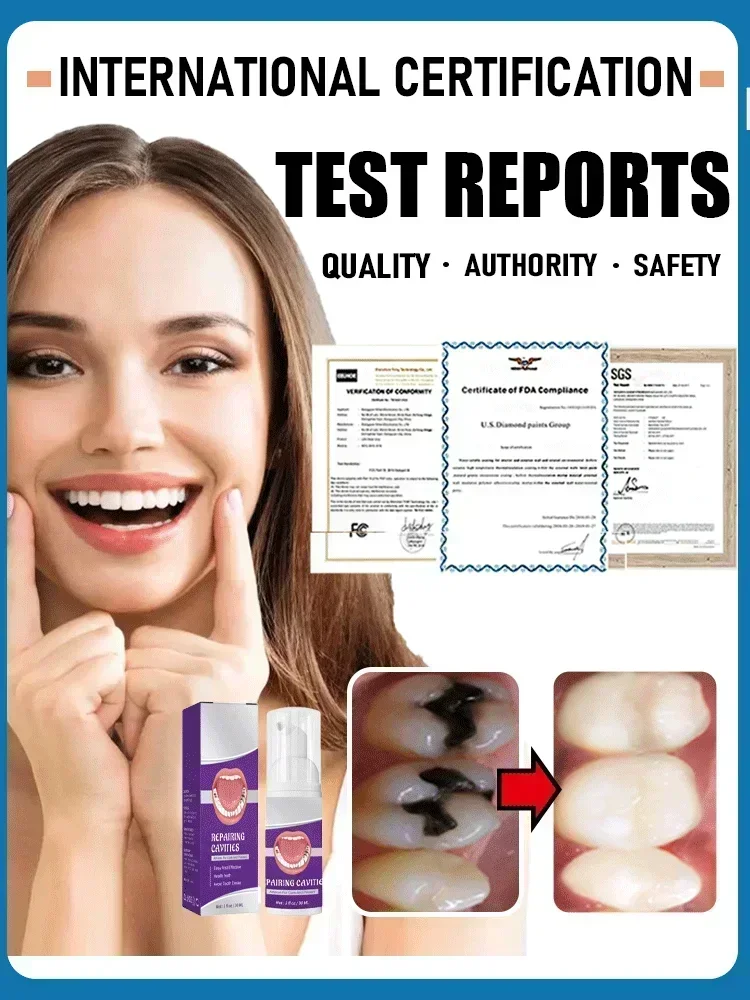 Effective Teeth Whitening Tooth decay repair  Calculus Plaque Periodontitis Remove Cavities