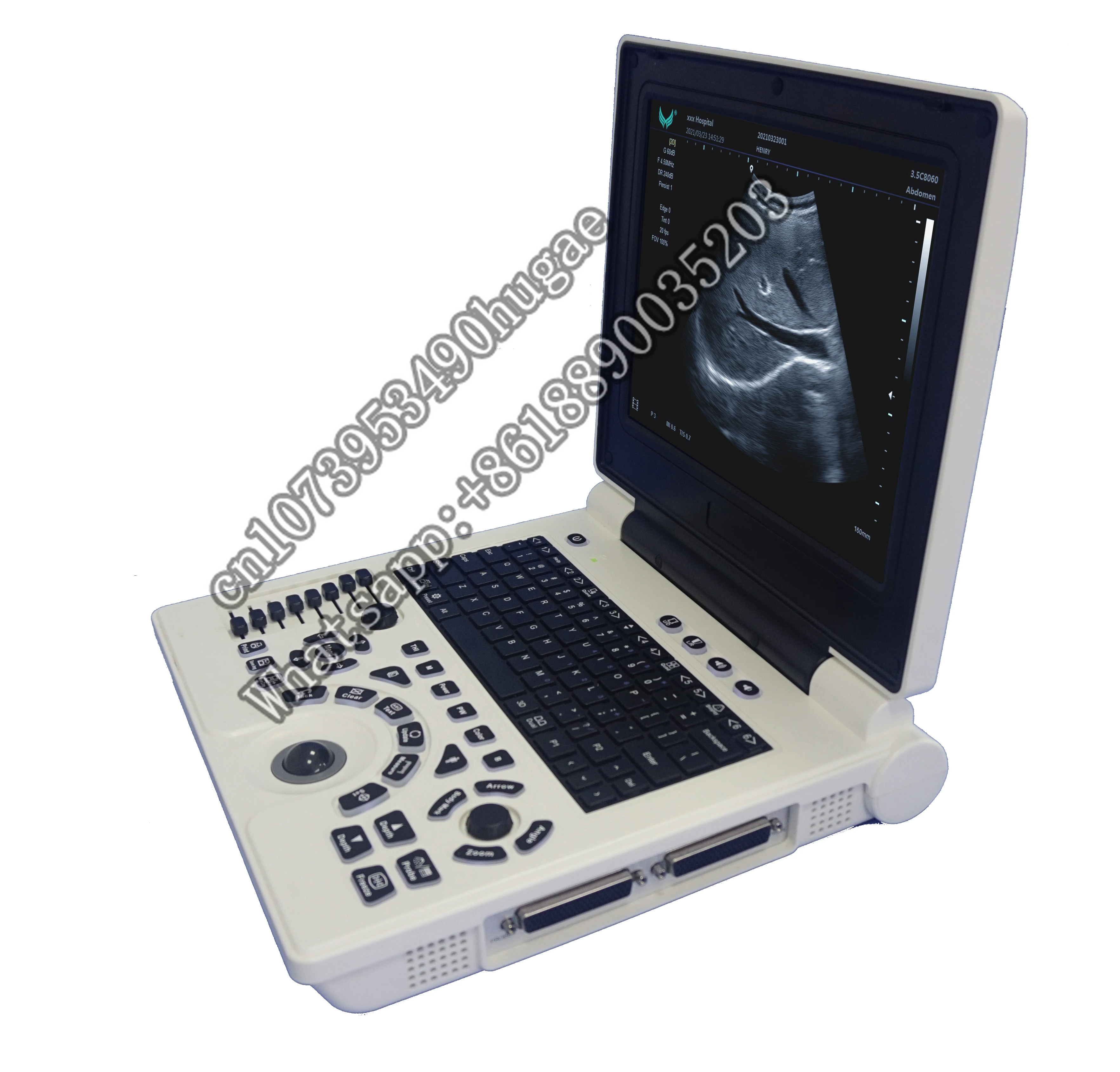 Diagnostic System Wireless Probe Scanner Medical Ultrasound Mobile For Pregnant Women portable ultrasound