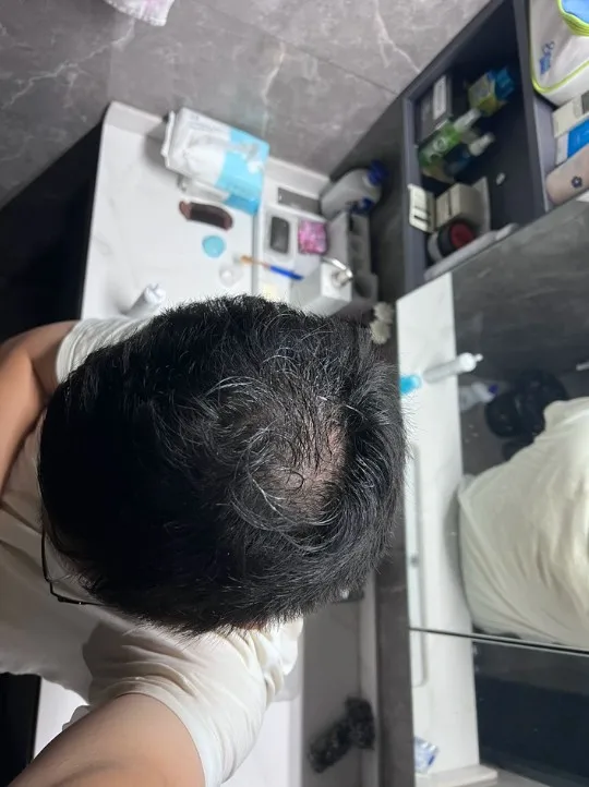 Customer review photo