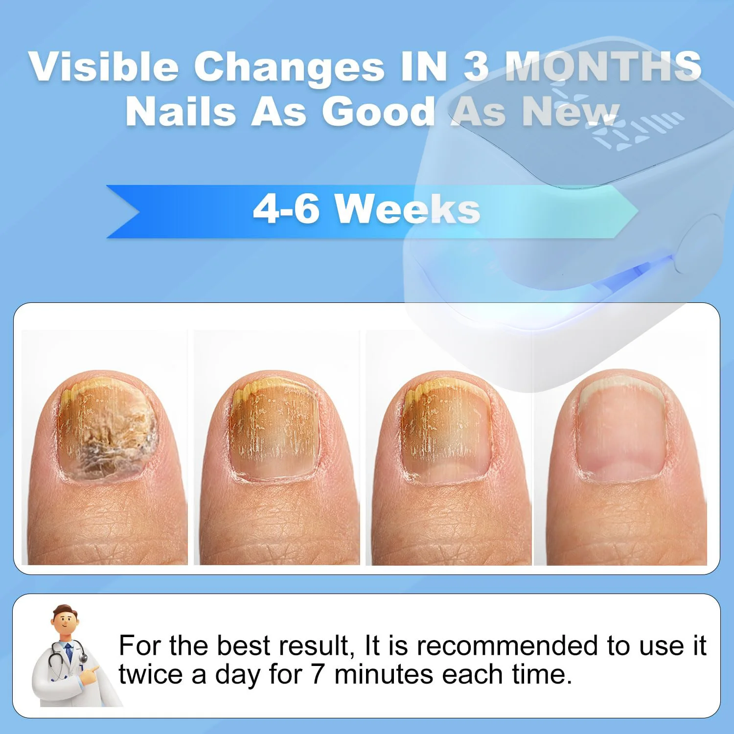 Dispositivo láser LED para tratamiento de hongos en las uñas, para limpieza de onicomicosis, carga USB, luz infrarroja de 905nm, luz azul de 470nm, salón de uñas