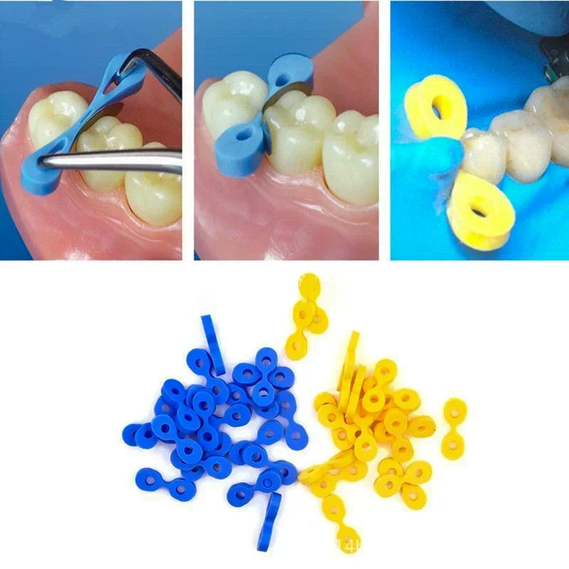 Dental Matrix Sectional Contoured Metal Matrices Bands Dental Matrix Rings Full Teeth Replacement  Oral Care view 2