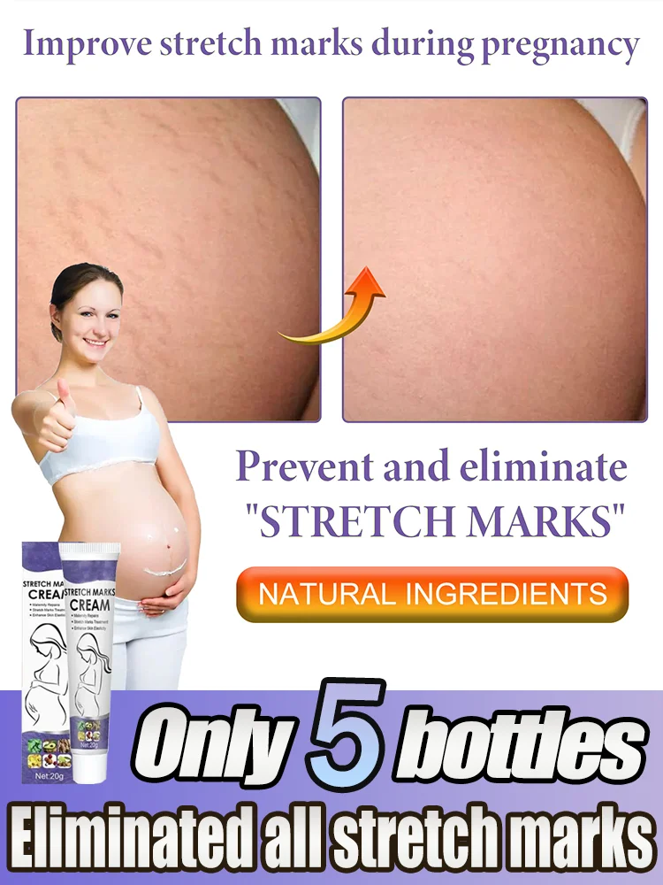 Fast Scar Repair Cream Skin Scar Repair Remove Pregnancy Surgical Scars Treatment Body Skin Care Cream