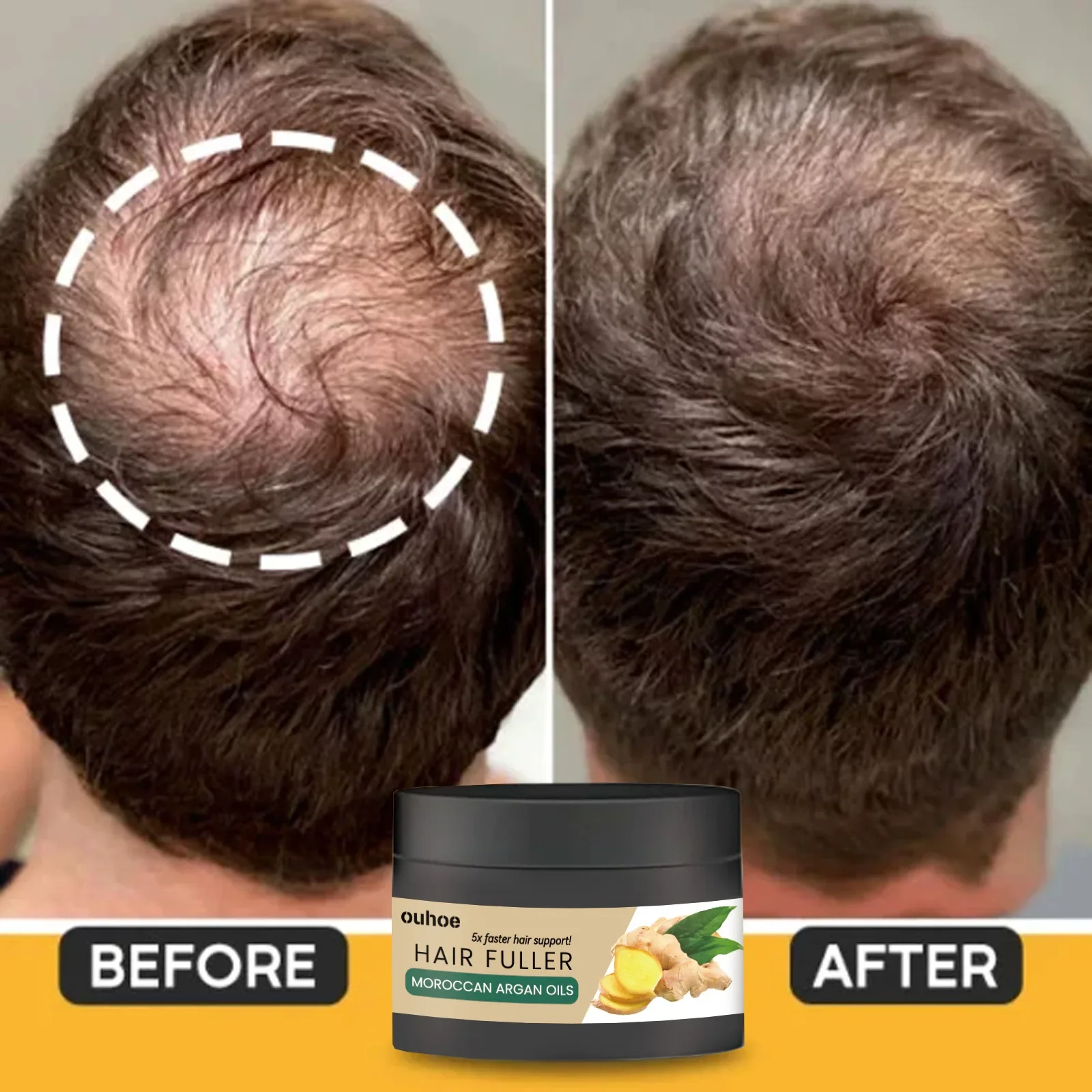 Hair Growth Cream Anti Hair Loss Baldness Scalp Treatment Prevent Dry Thinning Nourishing Repairing Men Hair Strengthening Cream