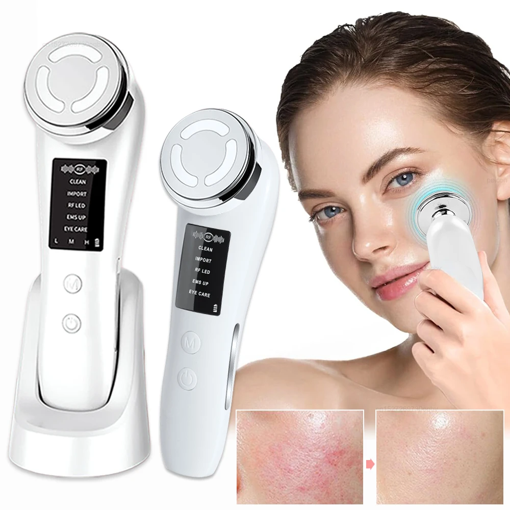 RF Facial Radiofrequency Facial Massager EMS Facial Microcurrent High Frequency Face Lifting Machine Skin Rejuvenation Device