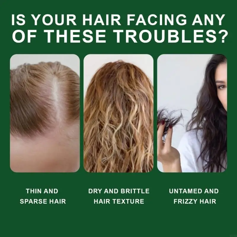 918d Tóc tăng trưởng kích thích Tóc dầu gội đầu kiểm soát dầu chăm sóc tóc