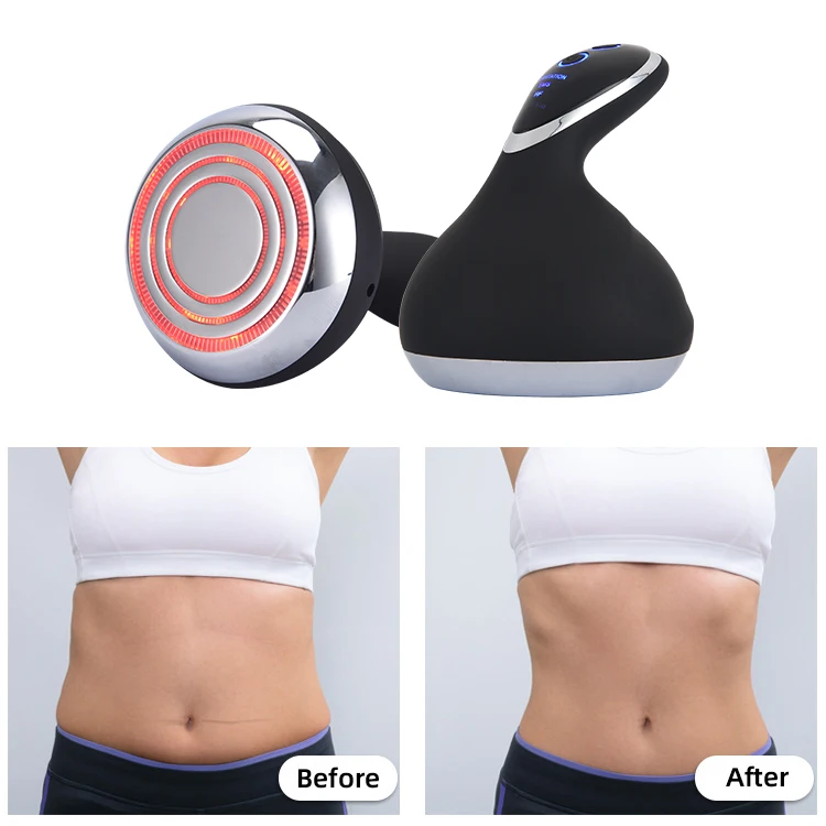 Устройство для сжигания жира, устройство для похудения от целлюлита, массажер для живота, удаление растяжек, машина для коррекции фигуры, чтобы сделать талию, маленький
