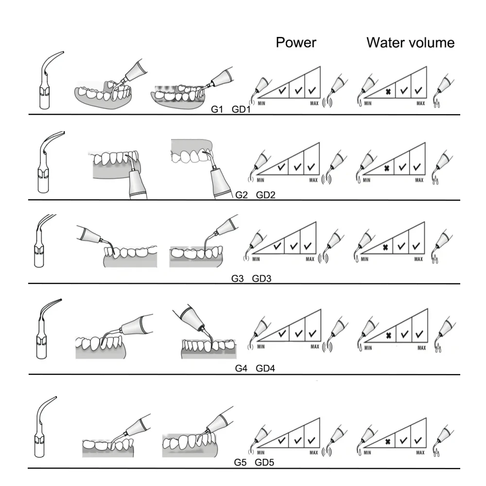 Woodpecker DTE Dental Ultraschall-Scaler-Aufsätze GD1 GD2 GD3 GD4 GD5 PD1 PD3 Passend für NSK Satelec Acteon – Detail 10