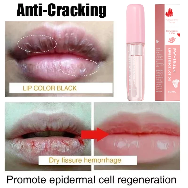 Rimuovere il fumo scuro Balsamo per le labbra Schiarente Melanina Sbiancamento Gloss Olio Labbra Rossetto rosa Esfoliante Dissolvenza Linee delle labbra Cosmetici coreani