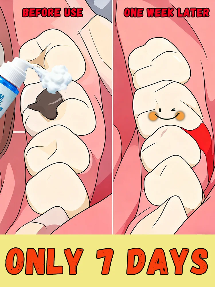 2025 Hot Sale Cleaning Intraoral Tools Foam Cleaner Intraoral Mousse Tool