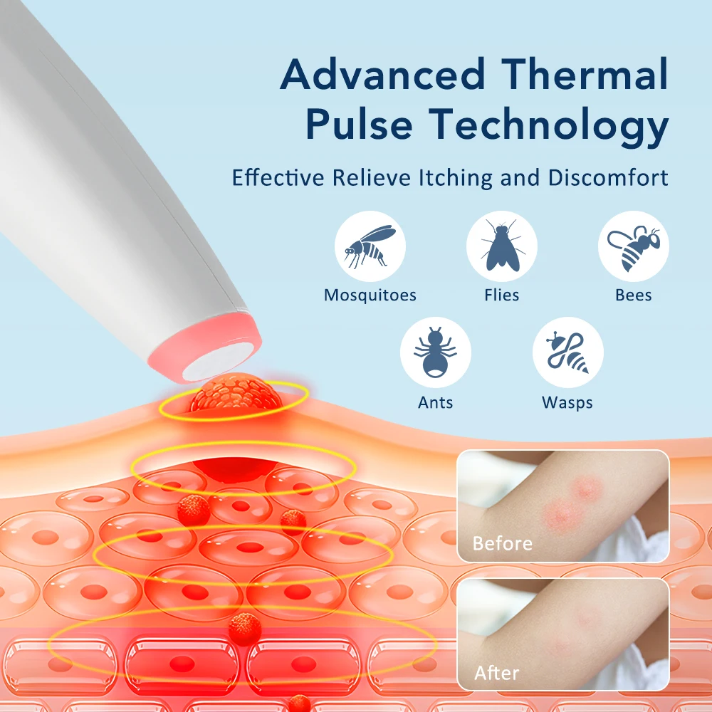 

Portable Mosquito Insect Bite Relieve Itching Pen Rechargeable Bug Bite Itch Relief Pen Electric Natural Mosquito Bite Heat Pen