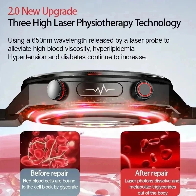 2024neue Saphirglas Laser behandlung drei hohe Smartwatch Männer Herzfrequenz Blutzucker Gesundheit Sport Tracker EKG ppg Smartwatch