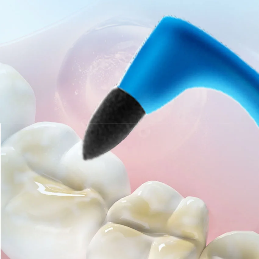 Dental stain cleaning rod, grinding tool, calculus remover, adult oral cleaning and dental care home grinding tool
