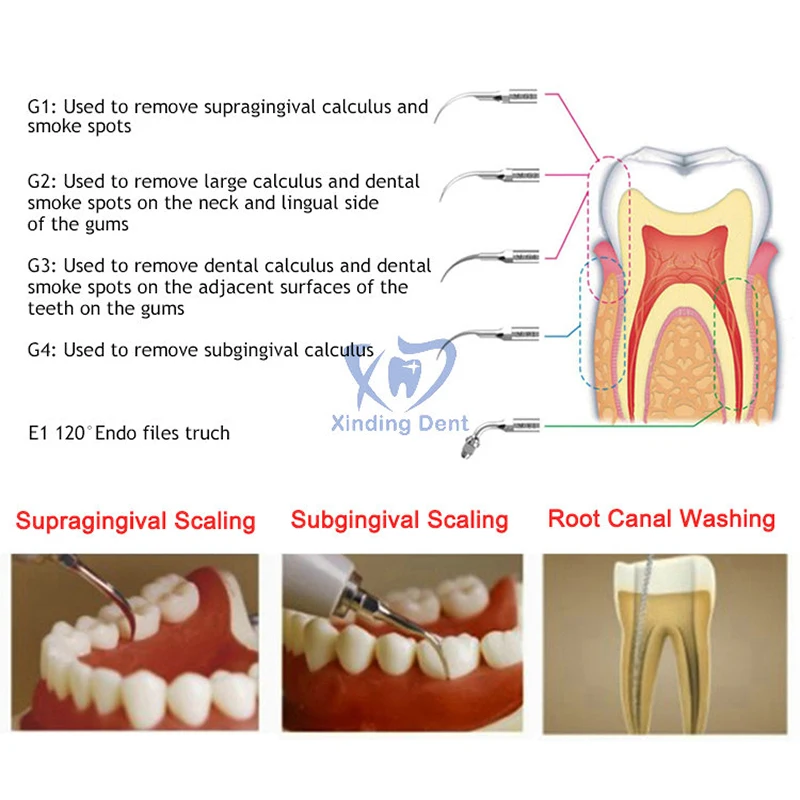 Skaler dentystyczny skaler ultradźwiękowy VRN A8 dla czyszczenie zębów z przewodami do sterowania bezprzewodowego