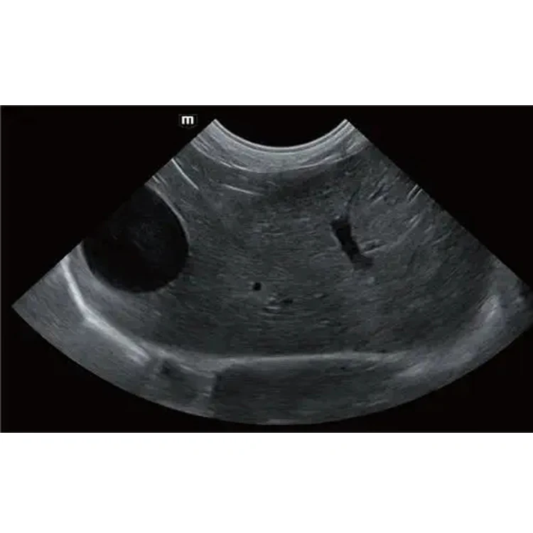 Mindray Vetus E7 Color Portable Ultrasonic Diagnostic Veterinary Ultrasound Examination Equipment