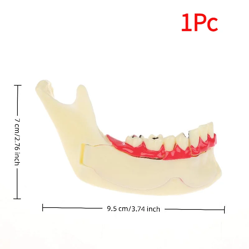 Dental Endodontic Treatment Model Anatomy Of Gums Mandible Tissue Anatomical Model Dentist Teach Study Demonstration Teeth Model