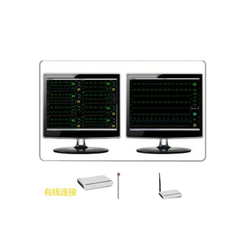 

SY-C012 hot sale medical hospital clinic central monitoring system price