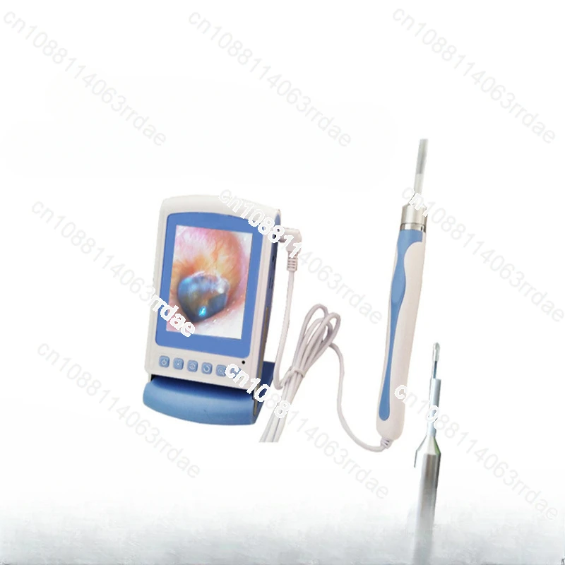 Visual ear spoon, otoscopes, display screen otoscope, ear otoscope.