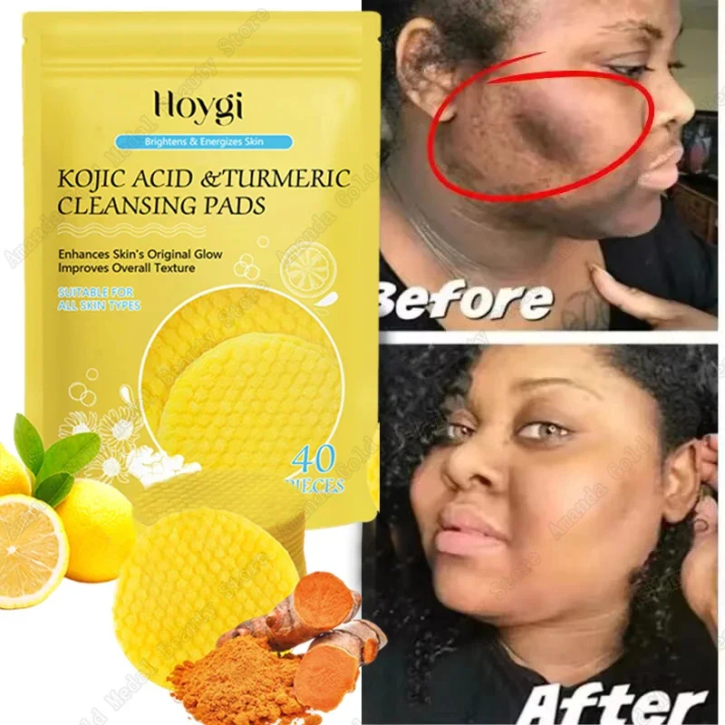 

Turmeric Kojic Acid Facial Exfoliating Cleansing Pad Lemon Deeply Cleansing Skin Brightening Whitening Cotton Pad Face Skin Care