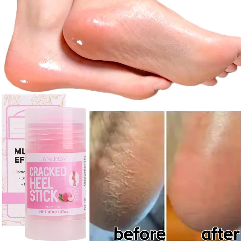 Ultra-Hydrating Foot Cream Feet Cream Stick Repairing Moisturizing Tool Softening Dry Cracked Feet Daily Foot Care Solution 40g