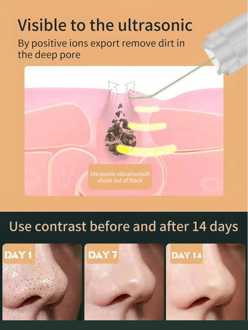 Ultrasone Huid Scrubber Gezichtshuid Verwijdering Aanscherping Verwijderaar Diepe Mee-Eter Gezicht Reiniging Lift Machine Schilschep Porie Cl