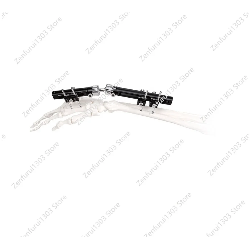 High Quality Orthopedic External Fixation Wrist Fixator External Fixator