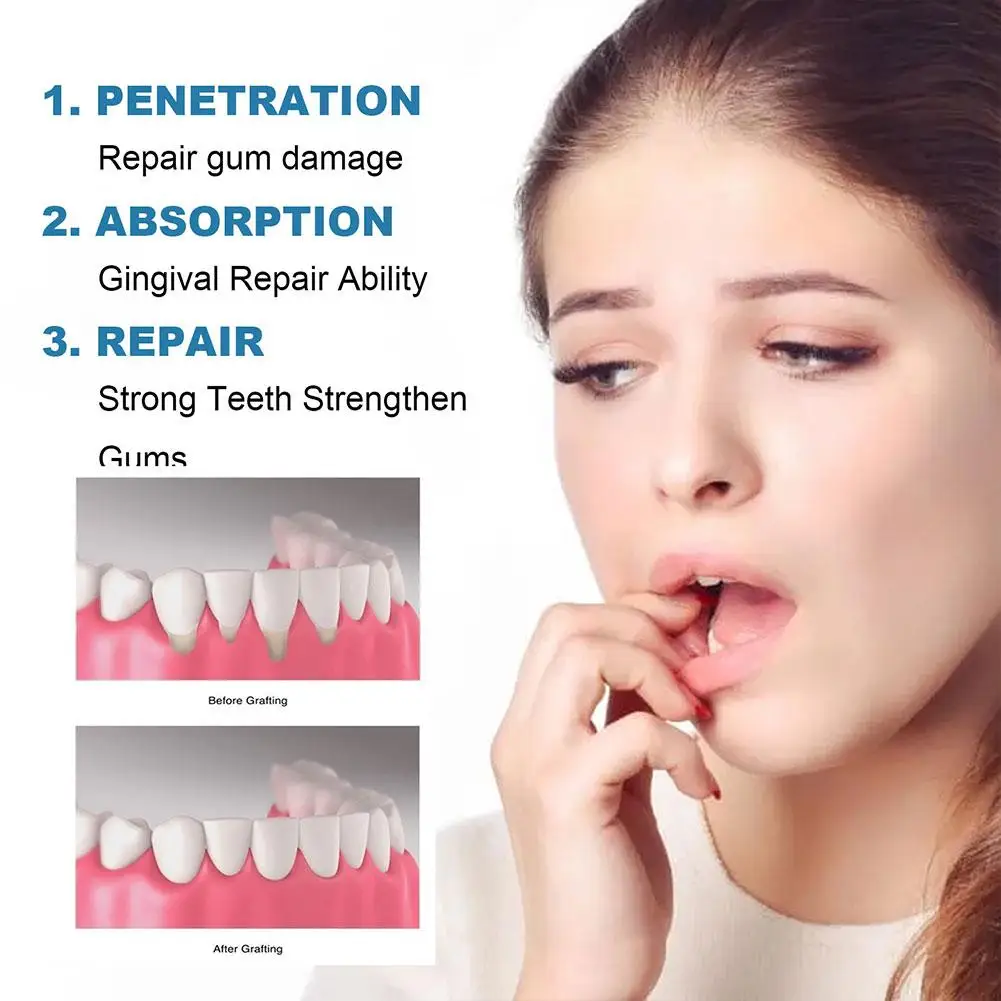 Rapidement Gum Repair Drops Serum, Charleroi Eve Toothache Cavities and Caries Whiten Care, RemGruYellow SAF Teeth Plate, X7E5