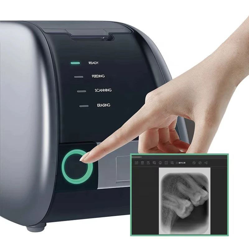 Digital Intraoral Phosphor Sensor Den al Phosphor Plate Scanner X Ray Scanner Phosphor Plate Scanner