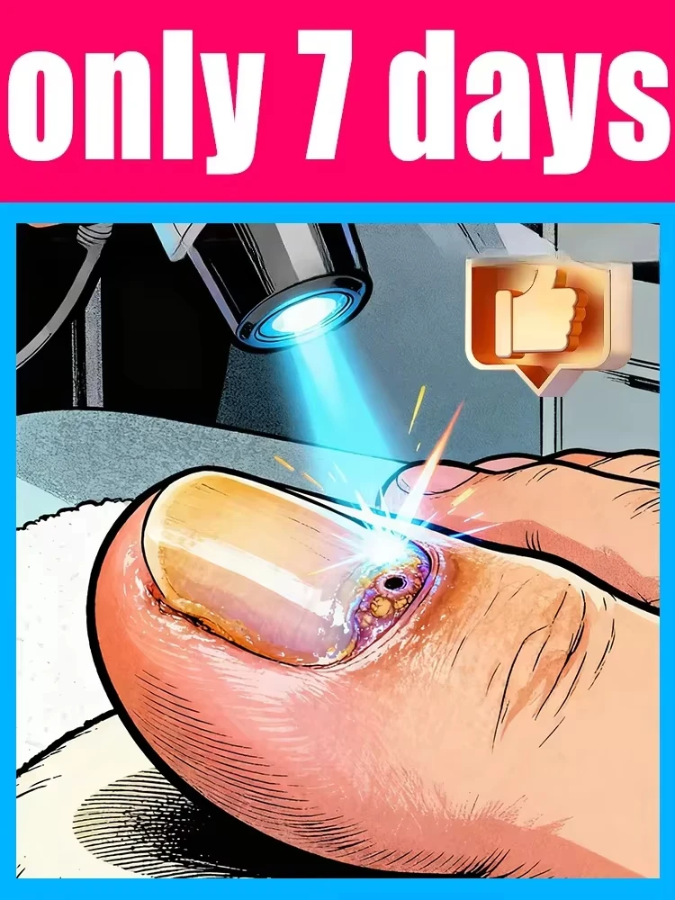 

The fifth generation of champagne-colored nail laser penʜᴇʟᴘs ʏᴏᴜ sᴀʏ ɢᴏᴏᴅʙʏᴇ ᴛᴏ ᴏɴʏᴄʜᴏᴍʏᴄᴏsɪs. Tᴇᴄʜɴᴏʟᴏɢʏ ᴄʜᴀɴɢᴇs ʏᴏᴜʀ ʟɪharᴇ。