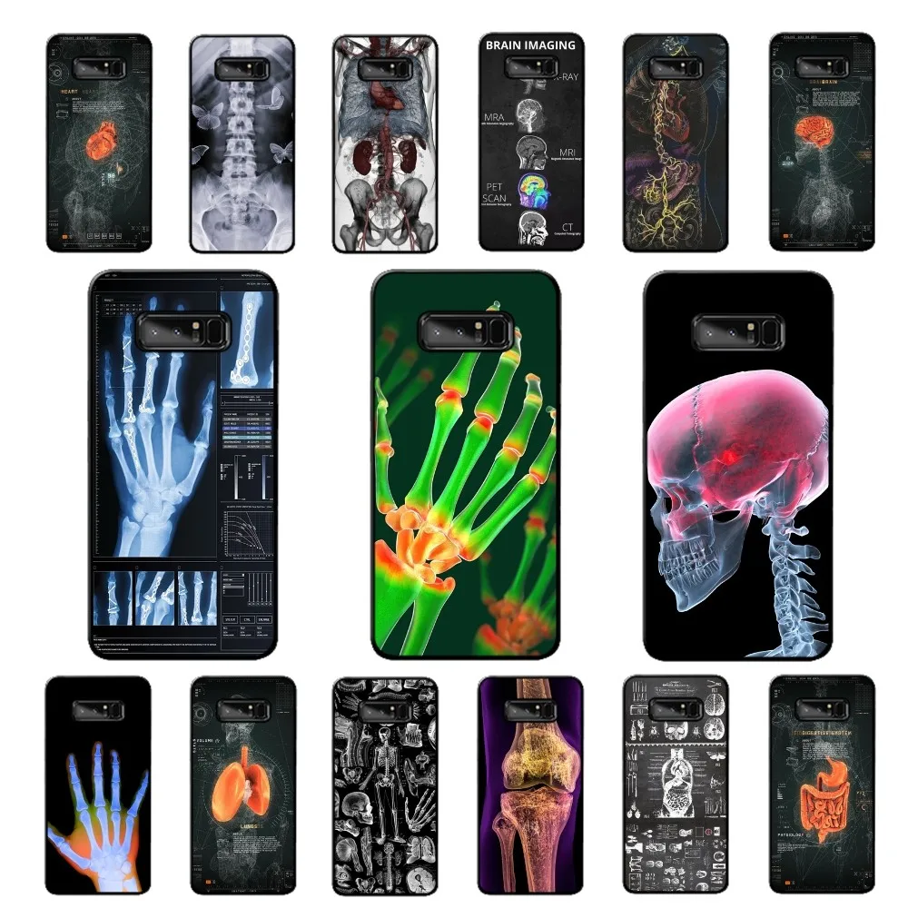 

Radiological human organs Skeleton Phone Case For Samsung Note 8 9 10 20 pro plus lite M 10 11 20 30 21 31 51 A 21 22 42 02 03