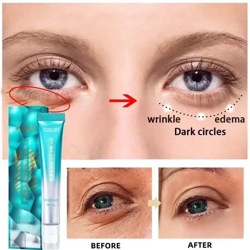 Anti Wrinkle Eye Cream Retinol Fade Fine Lines Anti-dark Circles Remove Eyes Bags Anti-aging Firming Eye Serum Eye Care Cream