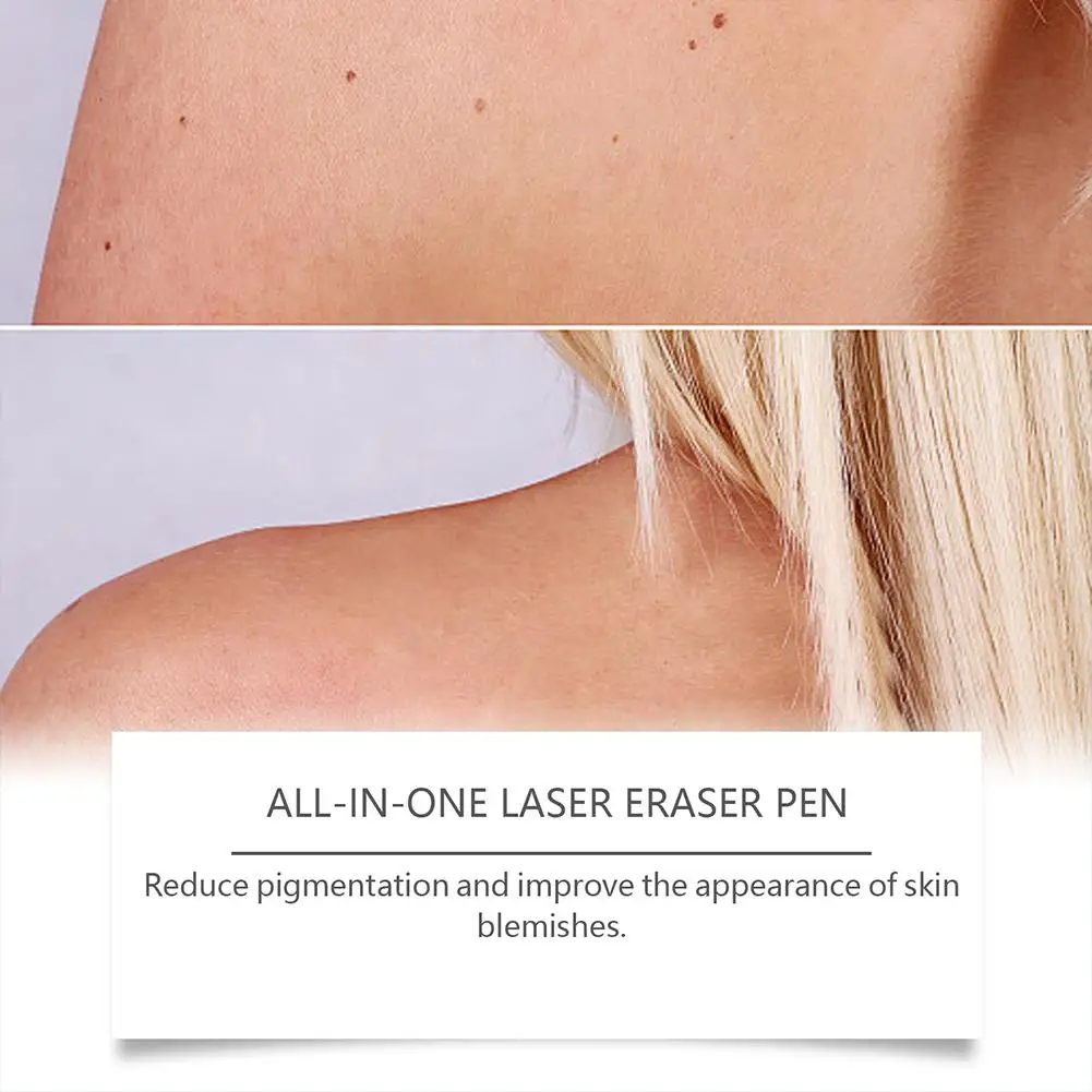 قلم بلازما ليزر احترافي ذو نقطة تجميد الضوء الأزرق آلة إزالة الشامات آلة تسمية ثؤلول الوجه تجميل الرؤوس السوداء #6