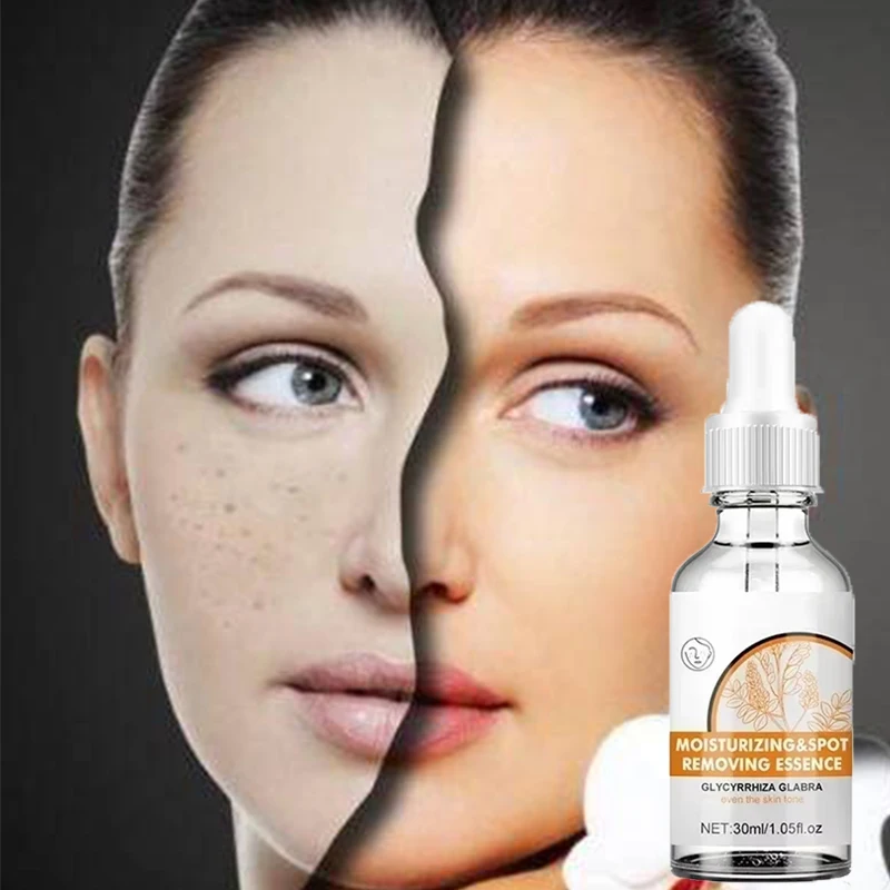 Anti-Freckles Whitening Lightening Serum Age Spots Chloasma Hydration Beautifying Moisturizing Facial Essence