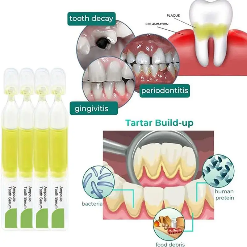 Teeth Cleaning Essence Bad Breath Stain Removal Essence Gentle And Safe Oral Cleaning Supplies For Home Hotel Dormitory Business