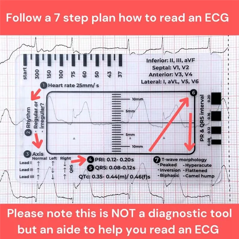 3Pc Ecg 7 Step Rule…