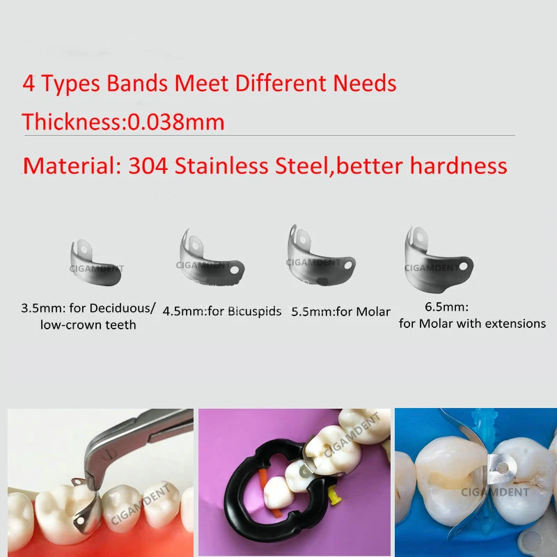 ทันตกรรมตัด Matrix ระบบ Palodent V3ทันตกรรมสไตล์ฟันส่วนทรงกลม Matrix สายเรซิ่นแหวนหนีบ