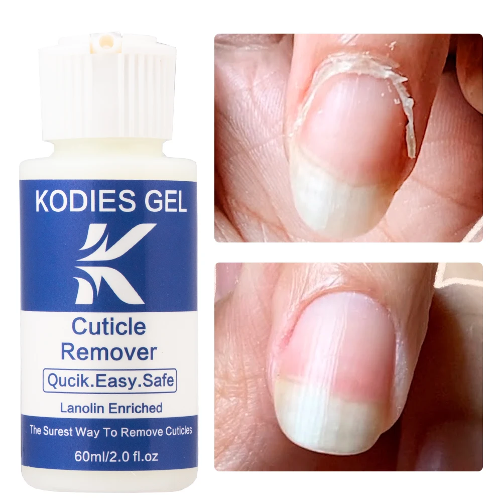 KODIES-Removedor de cutículas Gel, Amaciante de cutículas, Líquido, Calos do Pé Morto, Esfoliante, Nail Care, Reparação, Pedicure, Manicure, Ferramentas de Tratamento