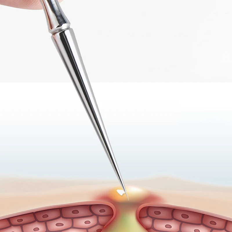 검은 점 여드름 블랙헤드 리무버 도구 바늘, 얼굴 청소용 여드름 도구 스푼, 코메돈 추출기, 모공 클리너