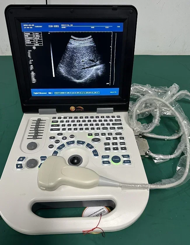 High-end Digital Medical Portable Echo Ultrasound Device Machine Black and white Sun-806G