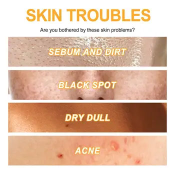 100g exfoliační peelingový gel na obličej, peeling na obličej, hydratační, rozjasňující, výživný, opravný peeling na obličej, krém na krásu a péči o pleť 10 nejlepší prodej chemický peeling - №7