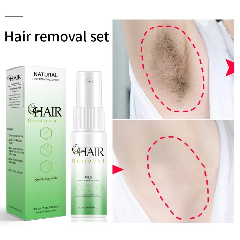 Pulverizador indolor da remoção do cabelo para senhoras e homens, 2 minutos, inibidor rápido do crescimento, pé, braço, axila, Depilatory permanente, cuidado do reparo