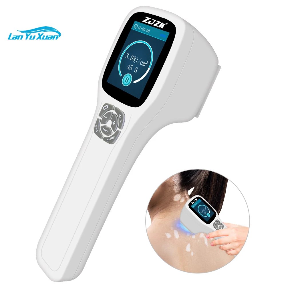

Uv Psoriasis Phototherapy Household Use Treatment Machine Cure for Vitiligo 308nm UVB Equipment White Colour Patches on Skin