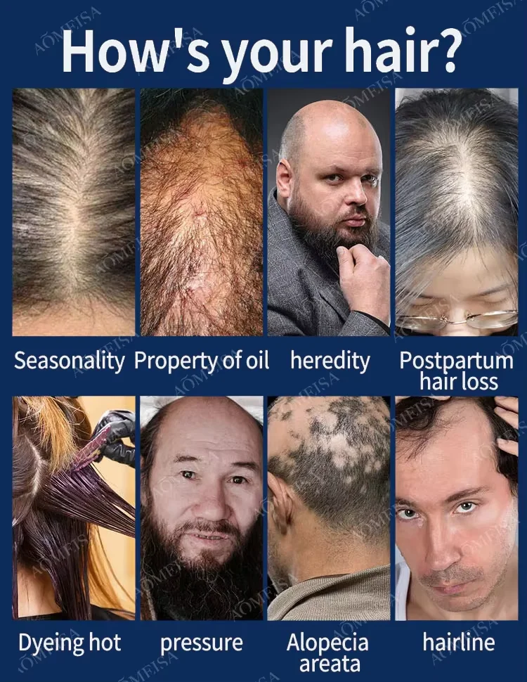 Tʜᴇ ʟᴀᴛᴇsᴛ ʜᴀɪʀ ɢʀᴏᴡᴛʜ ᴇssᴇɴᴛɪᴀʟ ᴏɪʟ ɪɴ 2024, ᴇғғᴇᴄᴛɪᴠᴇʟʏ ʀᴇᴘᴀɪʀs ʙᴀʟᴅɴᴇss