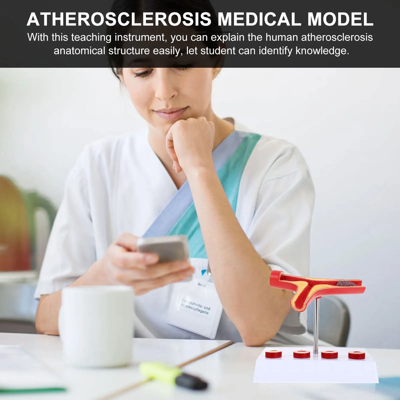 Cardiovascular Atherosclerosis PVC Realistic Blood Vessel Display Teaching Hospital Atherosclerosis Anatomical Show