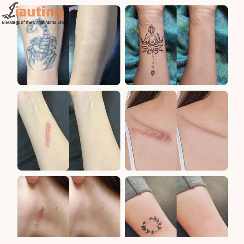 

15 Sheets Tattoo Cover Up Patch Tattoo Masking Tape Ultra Thin Patch For Tattoo Scar And Birthmarks Invisible Waterproof Skin